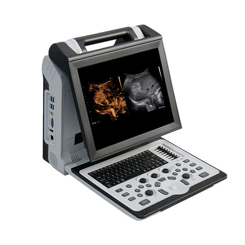 Tragbares Ultraschallgerät - Apogee 2300 Pro - SIUI - für Multifunktions-Ultraschall / für urologische Diagnostik / für Ultraschalluntersuchung von Muskeln und Skelett