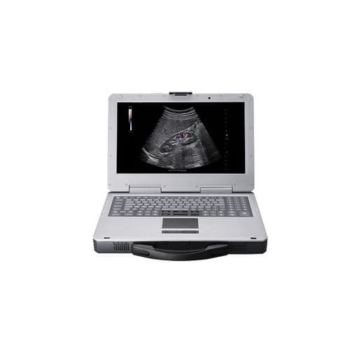 Tragbares Ultraschallgerät - Apogee 1000 Plus - SIUI - für Multifunktions-Ultraschall / Farbdoppler / Schwarz-Weiß