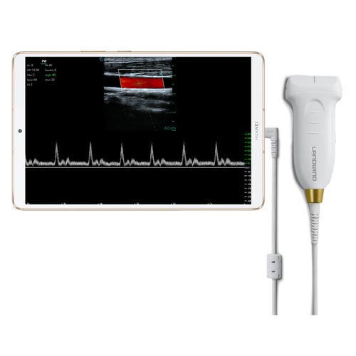 Ultraschall-Handgerät - Umagic S - Landwind Medical - für Multifunktions-Ultraschall / Schwarz-Weiß / Farbdoppler