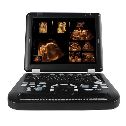 Tragbares Ultraschallgerät - CMS1700A - Sino-Hero - für Multifunktions-Ultraschall / Schwarz-Weiß / 3D/4D