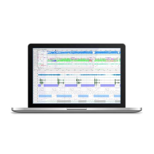Software für Schlaflabor - DOMINO  - SOMNOmedics  - Visualisierung / Analyse / für Patientendatenverwaltung