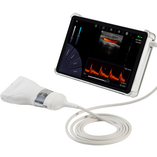 Ultraschall-Handgerät - U-Lite PRO - Sonoscanner - für bildgebende Ultraschalldiagnostik im Bauch- und Beckenbereich / für Multifunktions-Ultraschall / für pharmakologische Stressechokardiographie