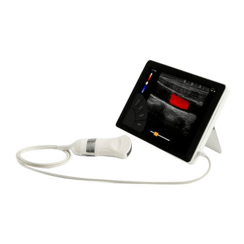 Tragbares Ultraschallgerät - T-Lite - Sonoscanner - für bildgebende Ultraschalldiagnostik im Bauch- und Beckenbereich / für Multifunktions-Ultraschall / für Ultraschalldiagnostik in Gynäkologie und Geburtshilfe