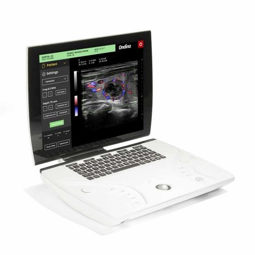 Tragbares Ultraschallgerät - Ondina - Sonoscanner - für Ultraschalldiagnostik in Gynäkologie und Geburtshilfe / für Multifunktions-Ultraschall / für Kardiologie