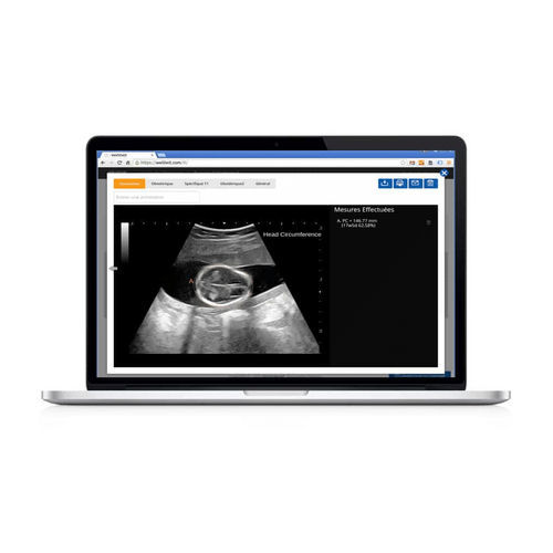 Analysesoftware - Sonoscanner - Sonoscanner - für medizinische Bildgebung