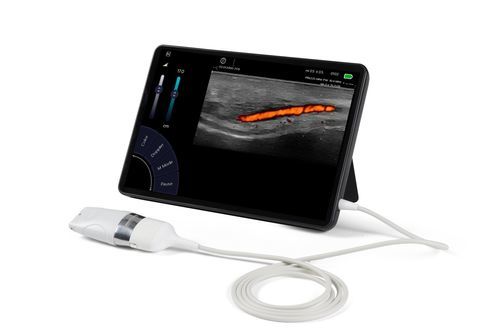 Lineare Ultraschallsonde - Sonoscanner - für Skelettmuskelerkrankungen / für Kleinstrukturen / Gefäß
