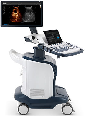 Plattformmontiertes Ultraschallgerät - S60 - SonoScape - für Multifunktions-Ultraschall / Farbdoppler / 3D/4D