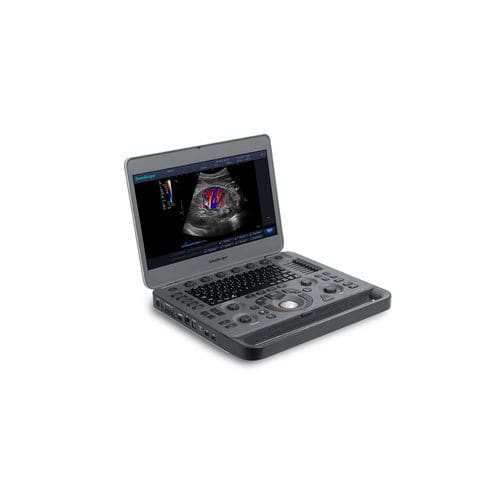 Tragbares Ultraschallgerät - X3 - SonoScape - für Multifunktions-Ultraschall / Schwarz-Weiß / Farbdoppler