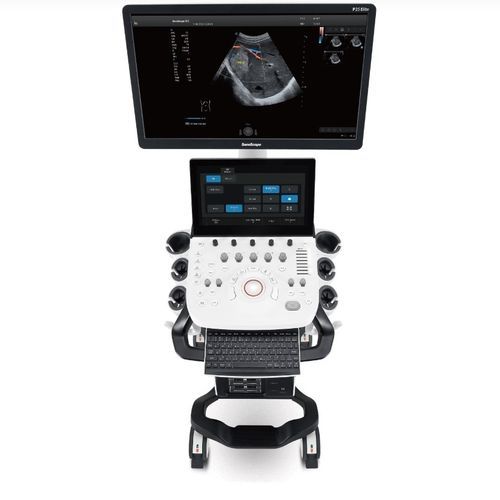 Plattformmontiertes Ultraschallgerät - P25 Elite - SonoScape - für Ultraschalldiagnostik in Gynäkologie und Geburtshilfe / für bildgebende Ultraschalldiagnostik im Bauch- und Beckenbereich / für Kardiologie