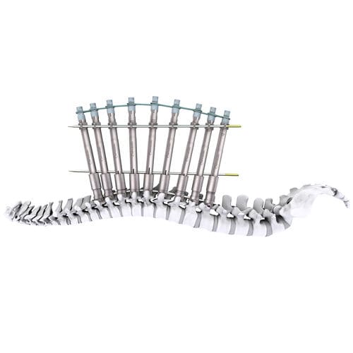 Pedikelschrauben-Positionierungssystem - mont blanc 3D+ - Spineway