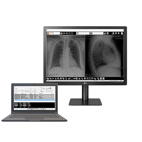 Software für Radiologie - Med Diag - Stephanix - Management / Visualisierung / Diagnose
