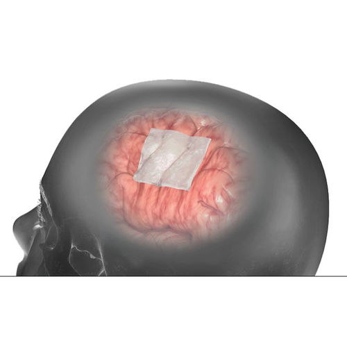 Dura Mater Substitutions-Prothese / Achillessehne der Rinder - DuraMatrix  - Stryker