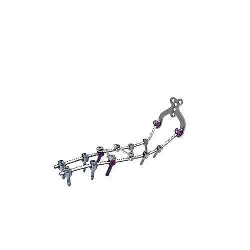 Okzipito-zervikothorakales Stabilisierungssystem für Osteosynthese - OASYS - Stryker - dorsaler Zugang / für Erwachsene