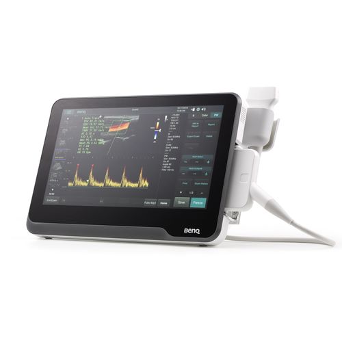 Tragbares Ultraschallgerät - T3300 - BenQ Medical Technology - für Multifunktions-Ultraschall / Schwarz-Weiß / Farbdoppler