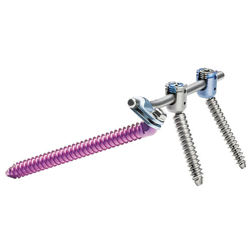 Ilio-sakrales Stabilisierungssystem für Osteosynthese - uBase™ - ulrich medical - dorsaler Zugang / für Erwachsene