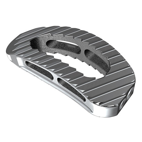 LWS-Zwischenwirbelimplantat - tezo-T™ TLIF - ulrich medical - lateraler Zugang / Titan