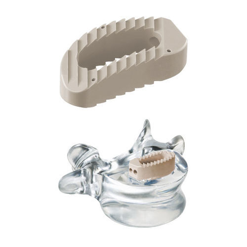 Lumbal-Sakral-Zwischenwirbelimplantat - pezo™ - ulrich medical - lateraler Zugang / aus PEEK