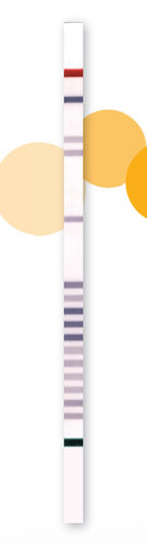 Teststreifen für HCS - StripAssay® - ViennaLab Diagnostics  - Gene / Blut / DNS-Analyse