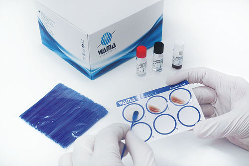 Reagenz / als Lösung - Wama Diagnostica - Labor / IgG / Rheumafaktor
