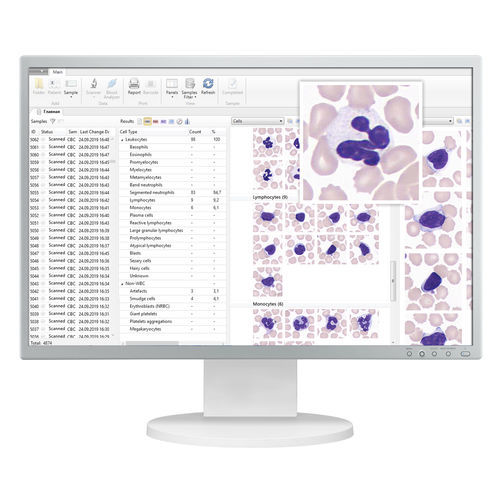 Automatisches Zell-Imaging-System - Vision Pro - West Medica - Labor / für Veterinärlabor / Diagnose