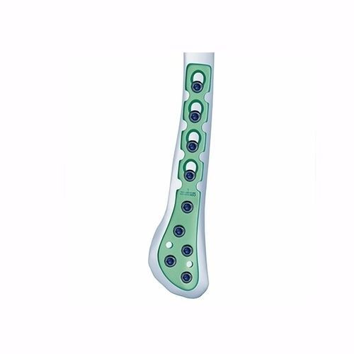 Kompressionsplatte für Fibula - Double Medical Technology - distal / seitlich / dorsolateral