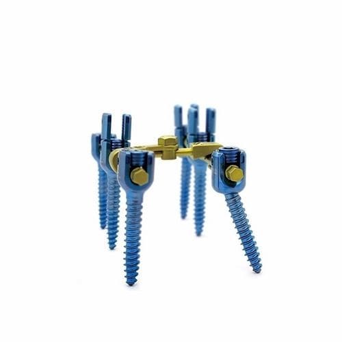 Stabilisierungssystem für Osteosynthese / Brust Lendenwirbelsäule und Kreuzbein - Double Medical Technology - dorsaler Zugang / für Erwachsene
