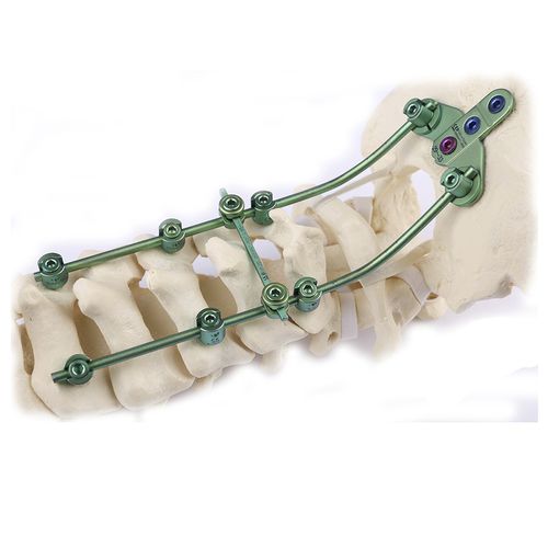 Okzipito-zervikales Stabilisierungssystem für Osteosynthese - Double Medical Technology - dorsaler Zugang / für Erwachsene
