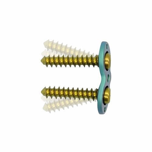 Kompressionsplatte für Epiphyse - Double Medical Technology - für Knöchel / mit Verriegelung / Metall