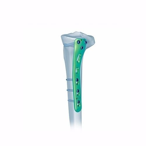 Kompressionsplatte für Tibia - Double Medical Technology - proximal / posteromedial / mit Verriegelung