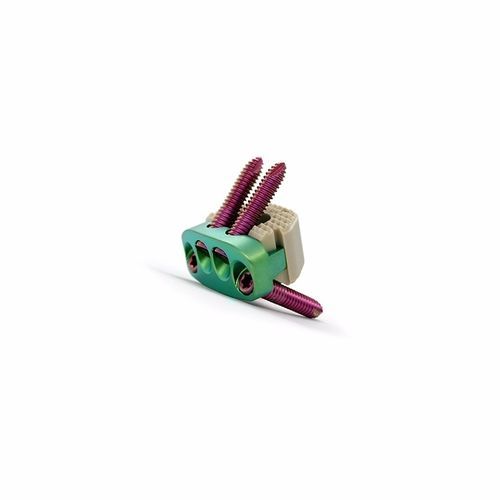 HWS-Zwischenwirbelimplantat - Double Medical Technology - ventraler Zugang