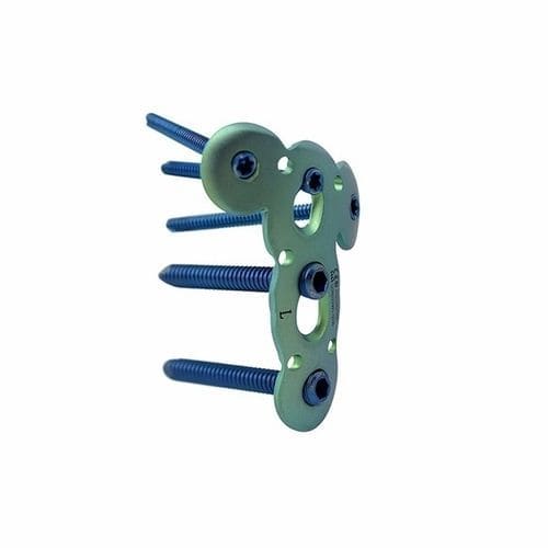 Kompressionsplatte für Humerus - Double Medical Technology - proximal / mit Verriegelung / Metall