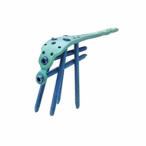 Osteotomieplatte für Ulna - Double Medical Technology - für Olekranon / proximal / mit Verriegelung