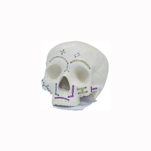 Kompressionsplatte für Gesichtsskelett - Double Medical Technology - Metall