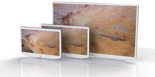OP-Monitor - XION medical - 32" / 27" / 23,8"