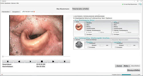 Diagnose-Software - Dysphagia - XION medical - Bewertung / medizinisch / für ärztliche Untersuchung