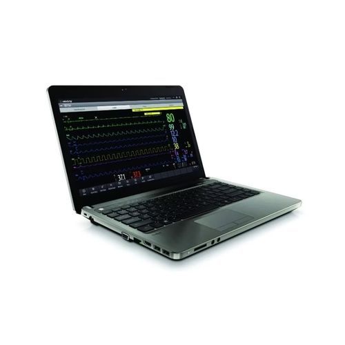 Viewer-Software - BeneVision CMS  - Mindray North America - fur Management des online ECG-workflow / Alarm / Patientendaten