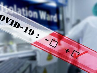 COVID-19-Schnelltest - Ambisea Technology - für Antikörper / IgG / IgM
