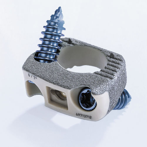 HWS-Zwischenwirbelimplantat - ArcadiusXP C® - Aesculap® - ventraler Zugang