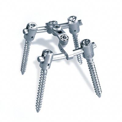 Thorako-lumbales Stabilisierungssystem für Osteosynthese - S4®   - Aesculap® - dorsaler Zugang / für Erwachsene