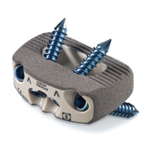 LWS-Zwischenwirbelimplantat - ArcadiusXP L® - Aesculap® - ventraler Zugang / aus PEEK
