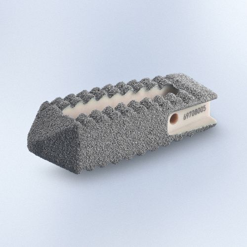 LWS-Zwischenwirbelimplantat - PROSPACE®XP - Aesculap® - dorsaler Zugang