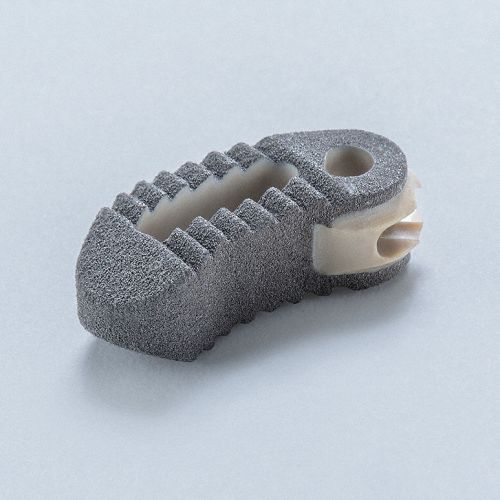 LWS-Zwischenwirbelimplantat - TSPACE®XP - Aesculap® - transforaminaler Zugang