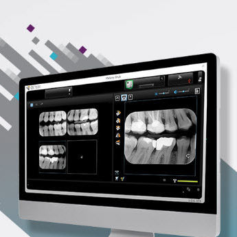 Visualisierungssoftware - CS Imaging version 8 - Carestream Dental - Datenverwaltung / für Patientendatenverwaltung / Diagnose