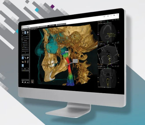 Software-Modul / Dental - CS Airway Module - Carestream Dental - für medizinische Bildgebung / Computertomographie / für dentale Bildgebung