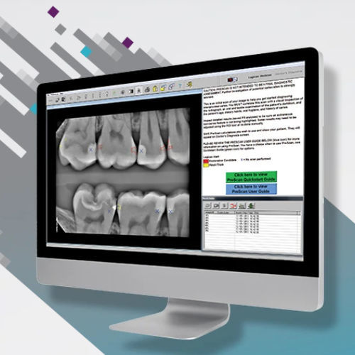 Software zur Kariesfeststellung - Logicon Caries Detector - Carestream Dental - Visualisierung / Analyse / Datenverwaltung