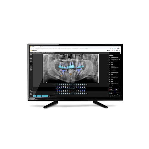 Analysesoftware - AI Insights - Carestream Dental - Diagnose / Reporting / Bildanalyse