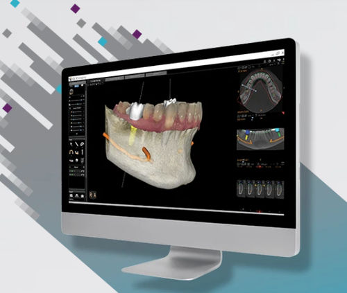 Visualisierungssoftware - CS 3D - Carestream Dental - Analyse / für Patientendatenverwaltung / Diagnose