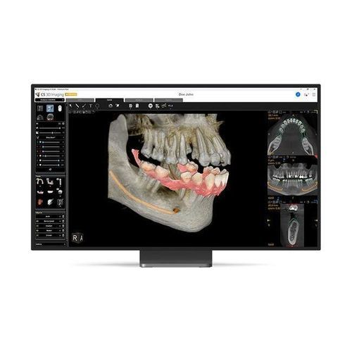 Projektentwicklungssoftware - CS 3D Imaging Premium - Carestream Dental - für Zahnprothese-Design / 3D-Visualisierung / 3D-Simulation