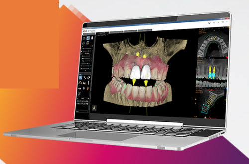 Software-Modul / Management - Carestream Dental - Projektentwicklung / Umform / Reporting