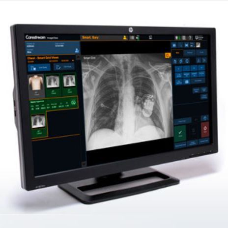 Analysesoftware - ImageView - Carestream - Steuerung / zur Infektionskontrolle / Viewer
